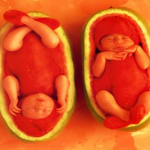 γάμος : εγκυμοσύνη, μένοντας έγκυος, δίδυμα, διπλή κύηση - Μείνετε έγκυος σε δίδυμα